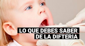Difteria: Aquí te contamos en qué consiste esta infección