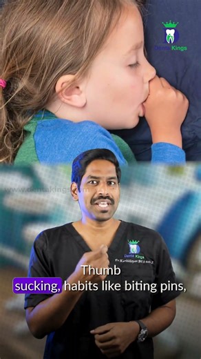 என் பல்லு நடுவுல ஏன் கேப் இருக்கு? - There is a gap between my teeth | Dr.Karthikeyan | Denta Kings