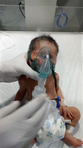 #NewbornNebulizer#NICUProtocol#NeonatalCare#Nebulization#RespiratoryDistress #newborncare