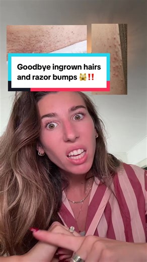 Ladies.. you do NOT have to live with those embarrassing ingrown hairs and razor bumps…