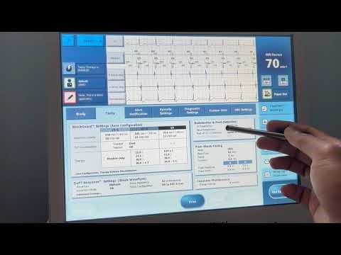 Merlin PCS Demo - ICD Programming | Part 4