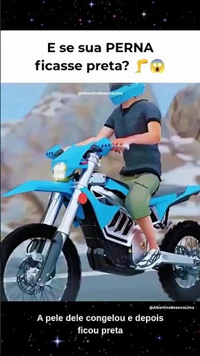 What if it was your leg? 🦵😳