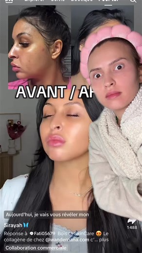 Découvrez les bienfaits du collagène pour la peau