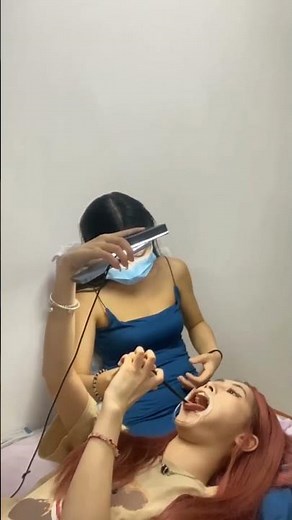 mm口腔喉咙扁桃体检查舌头FetishTeeth了解更多加q507871282