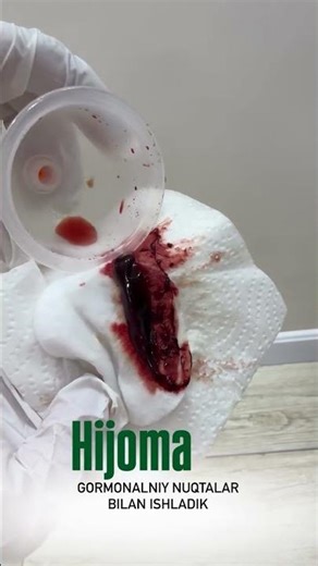 +99894 099 87 00 Izzsiz hijoma asoschisi – sehr, zuluk va ayollar uchun muolajalar!