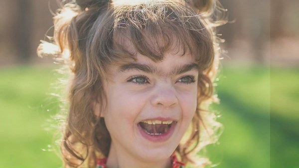 North Carolina girl with rare Sanfilippo Syndrome loses access to promising treatment after clinical trial ends