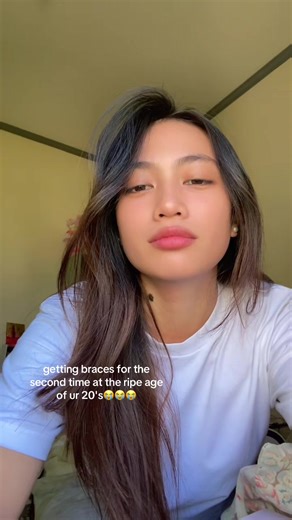 Getting Braces Again in Your 20s: My Journey