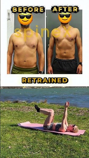 How to train after spinal fusion
