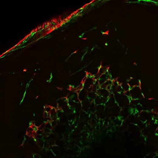 Inside a Vascular Organoid