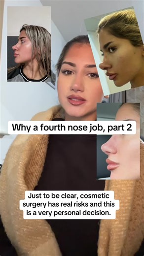 Understanding My Fourth Nose Job Journey: Part 2