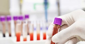 NFS : comment interpréter une numération formule sanguine ?