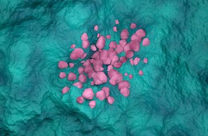 Why a Targeted Therapy Is Better Than Immunotherapy for Some Patients With Inoperable Non-Small Cell Lung Cancer