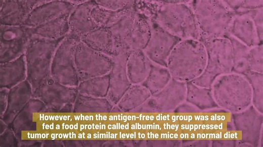 Consuming more meat & milk may help prevent gut cancers