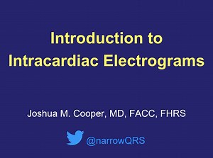 Introduction to Intracardiac EGMs - British Heart Rhythm Society