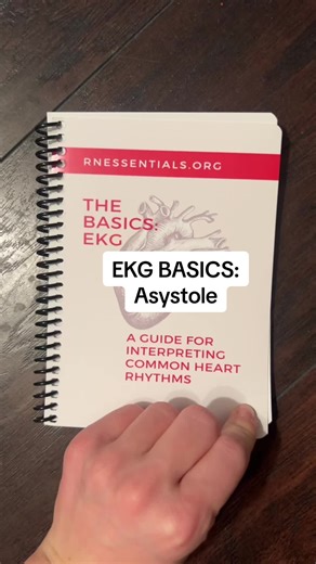 EKG basics! How well do you know asystole? Do you know what to do if your patient goes into asystole? This rhythm requires immediate treatment! #ecg #ekg #ekginterpretation