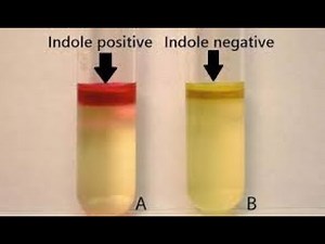 IMViC test (Indole test) in less than 5 minutes 🤓 شرح مبسط