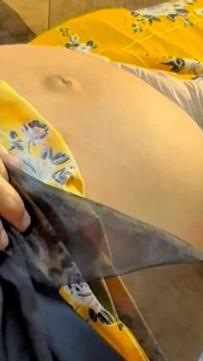 Obstetric Examination steps