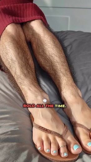 Empowering Hairy Women on Instagram: "https://patreon.com/c/EmpoweringHairyWomen ✨ Join us on Patreon today ✨ She’s flaunting her stunning, naturally hairy arms and legs – unapologetically her true self. Craving more empowering moments like this? Double-tap if you agree, save for daily inspo and tag a friend who needs to see real beauty. Comment #EmpoweringHairyWomen to join our movement celebrating unapologetic radiance! #feminine #hairy #hairygirl #hairywoman #armhair #hairyarms #leghair #hair