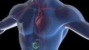31 reactions | Scientists from the Laboratory of Integrated Actuators at EPFL School of engineering, in collaboration with the University of Bern, have successfully implanted – in vivo – their first artificial tubular muscle that augments the aorta and assists cardiac function in pumping blood. Find out more: go.epfl.ch/2ffefc Article en français: https://go.epfl.ch/84e734 | EPFL | Facebook