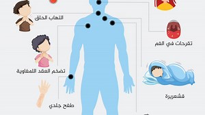 أعراض الإيدز.. وما أصله؟