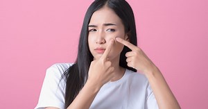 Envie de vous percer un bouton ? Ne zappez surtout pas cette étape pour éviter qu'il revienne