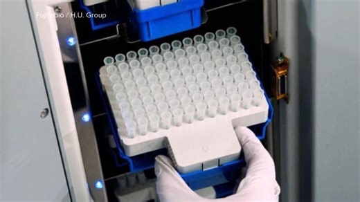 FDA clears 1st blood test to help diagnose Alzheimer's disease