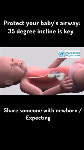theknownpulse on Instagram: "Protect Your Baby’s Airway 👶💨 After feeding, keeping your newborn at a 35° incline helps prevent regurgitated milk from entering the airway — reducing the risk of choking and aspiration. Flat-lying position increases reflux because gas pushes milk upward. A slight incline supports safer digestion and easier burping. Tip: Hold your baby upright for 20–30 minutes after feeding. 🔹 Inspired by WHO infant care recommendations 🔸 Share this with new or expecting parents