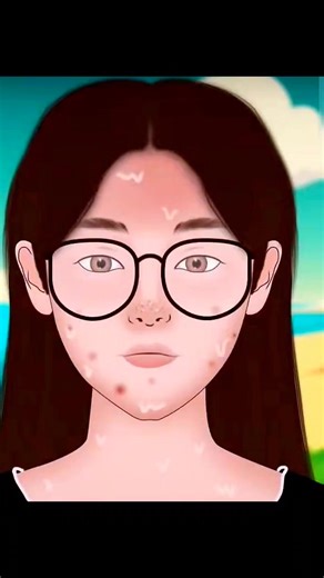 ASMR Satisfying Huge Blackheads Removal Treatment Animation | ASMR Beauty #fypシ #asmrvideos #earwaxremoval #asmrcommunity #animation #viral #trending #asmr #viralreels #facebookreels #Viralシ #asmrbeauty | ASMR Beauty