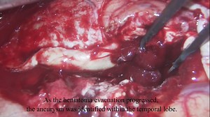 CASE25-214 Video 1