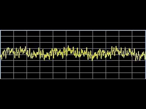 Inflammation - Rife Frequencies