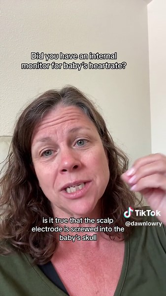 Replying to @Vanessa b303 did they use an internal monitor to monitor your babies heart rate during labor?#laboranddelivery #childbirth #birth #laboranddeliverynurse #pregnant #contractions #induction #pitocin #cesarean #interventions #shareddecisionmaking #informedconsent #risk #fetalscalpelectrode #fse