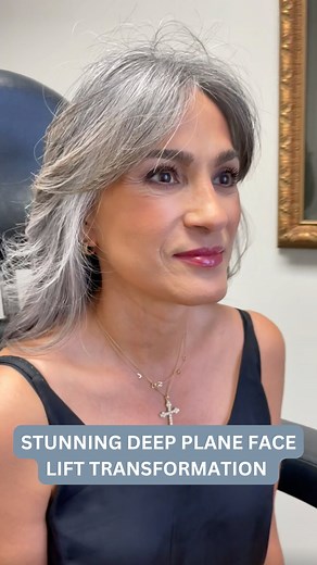 22 reactions | Aging changes more than just the skin, it softens...