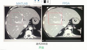 level_set硬件加速后与软件算法对比视频
