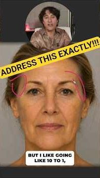 WHAT IS AGING HER ??
