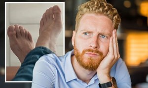Cancer symptoms: Signs on your feet that may indicate a skin tumour