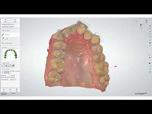 Segmenting the teeth in the model in Clear Aligner Studio