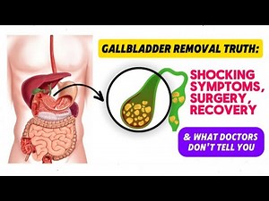 Gallbladder Removal: Hidden Symptoms, Recovery Tips & What Doctors Won’t Tell You
