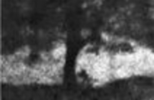 Watch the moment the famous Sycamore Gap tree was cut down to fall on England's Hadrian’s Wall