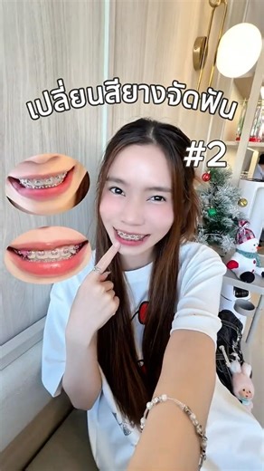 Vlog: Changing the color of orthodontic rubber bands ep.2 #vlog #dentist #orthodontics