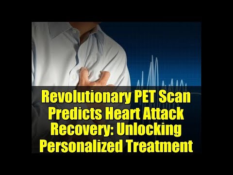 Revolutionary PET Scan Predicts Heart Attack Recovery: Unlocking Personalized Treatment