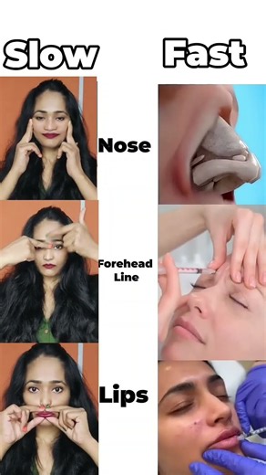 how to get rid of forehead wrinkle how to remove laugh lines naturally😍Plump lips, slim nose+ fatty