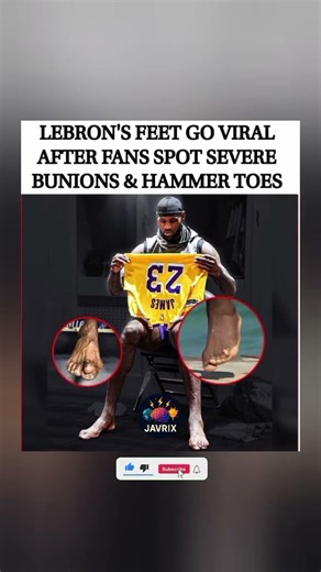 LeBron's Feet Go Viral for Crazy Deformities 😳👟 #shorts #trending #viral