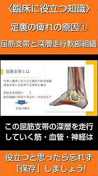 臨床に役立つ知識 足裏の痺れの原因① 屈筋支帯と深層走行軟部組織