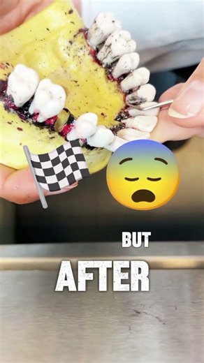 Dental Exam Gone WRONG 🦷💀😱