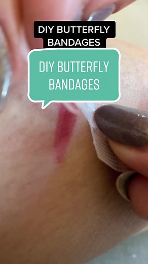 How to Make Butterfly Bandages for Small Wounds