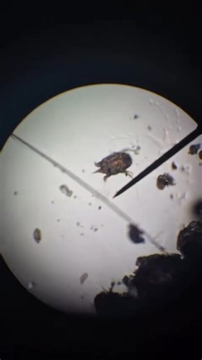 Met het blote oog niet te zien maar onder de microscoop wel; mijten. Het vermoeden werd bevestigd nadat een afkrabsel onder de microscoop werd bekeken 🔬 Krijgen jullie er ook spontaan jeuk van? | Dierenartsencombinatie Holten