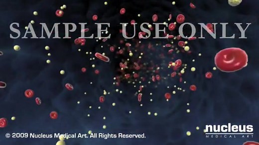 【科普】General Anesthesia全身麻醉(3D动画)