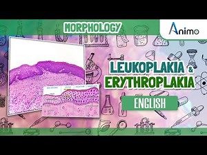Leukoplakia and Erythroplakia | GIT Morphology | English