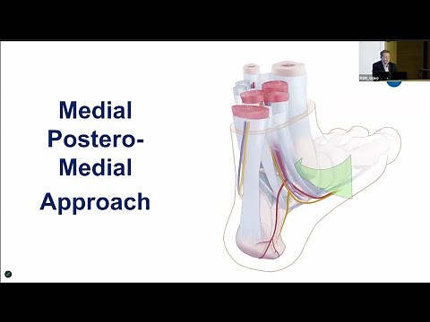 Medial Posteromedial Approach for Posterior Malleolar Fracture Fixation.