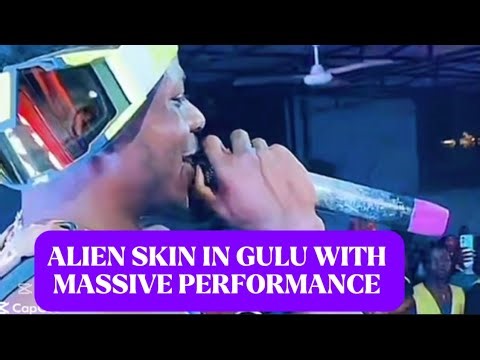 ALIEN SKIN IN GULU LIVE PERFORMANCE ROCKED NORTHERN UGANDA 🇺🇬 #alienskin #music #duet
